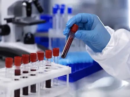 Shamonda Virus Infects Human in France, WHO Monitoring Situation